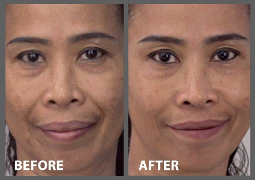 2 Minute Miracle Peptide+ Serum-thumbmail-2