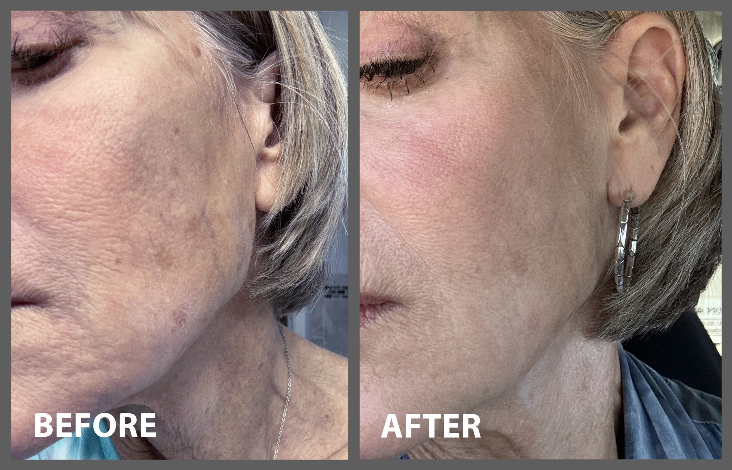 2 Minute Miracle Peptide+ Serum-thumbmail-1