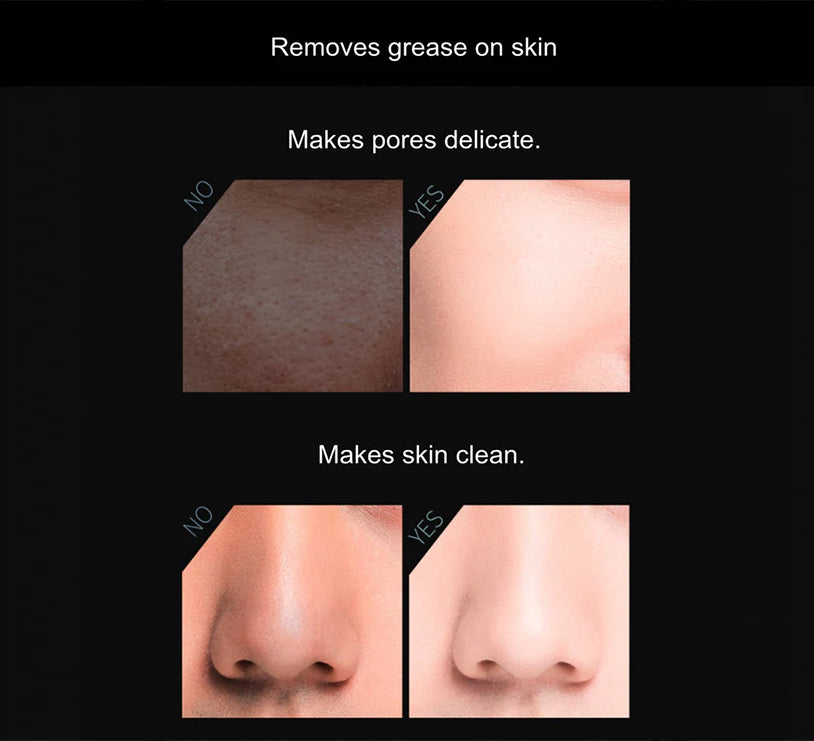 Volcanic Stone Oil-Absorbing Face Roller-thumbmail-1