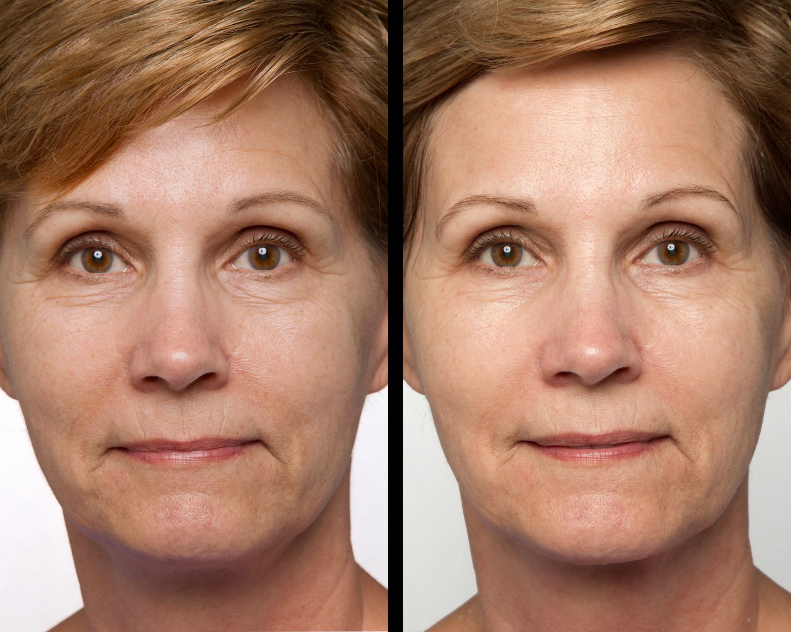 2 Minute Miracle Gel